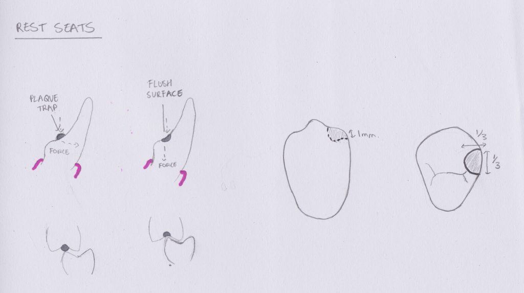 RPD - Design - Revise Dental